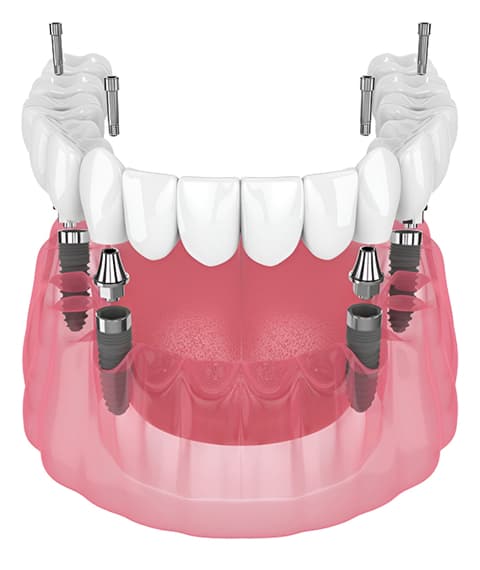 Why Choose Lakeshore Dental?