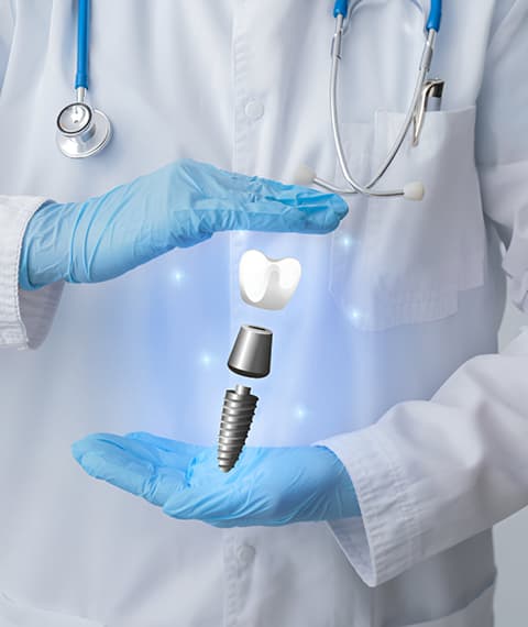 Am I a Candidate for All-on-4 Dental Implants?
