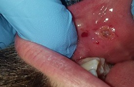 Lump removed from soft tissue