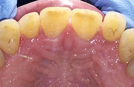 Healthy white tooth structure