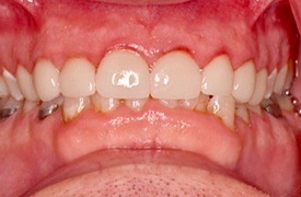 White healthy smile