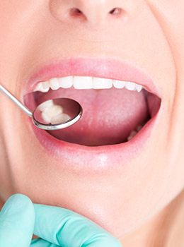 Closeup of patient receiving dental care