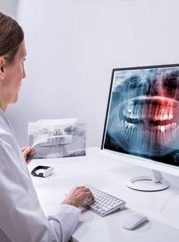 Dentist reviewing dental x-rays