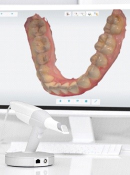 Digital dental scan