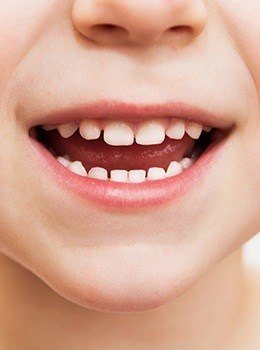 Closeup of child's healthy smile