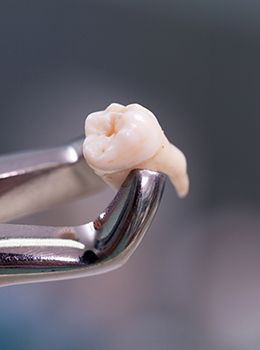 Metal clasp holding extracted tooth